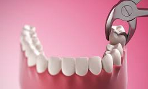 Oral Surgery